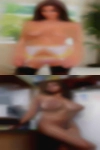Girls stretch Marks